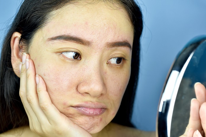 Veido odos priežiūra žiemą: 4 patarimai iš vizažisto