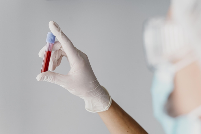 Kokius kraujo tyrimus gali paskirti šeimos gydytojas?